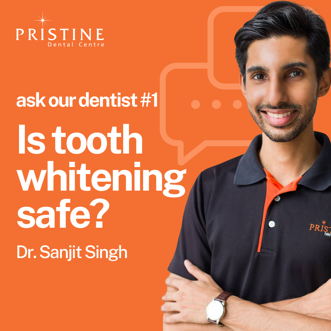 Tooth Whitening Video