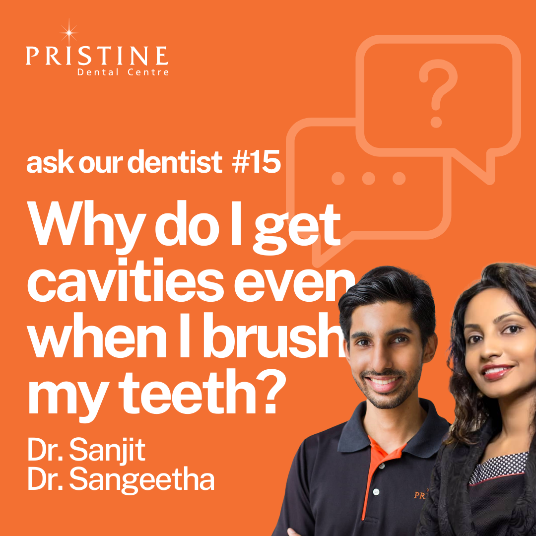 Dental Cavities