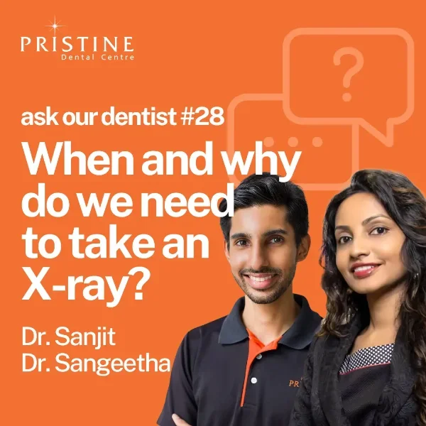 When take dental x-ray?