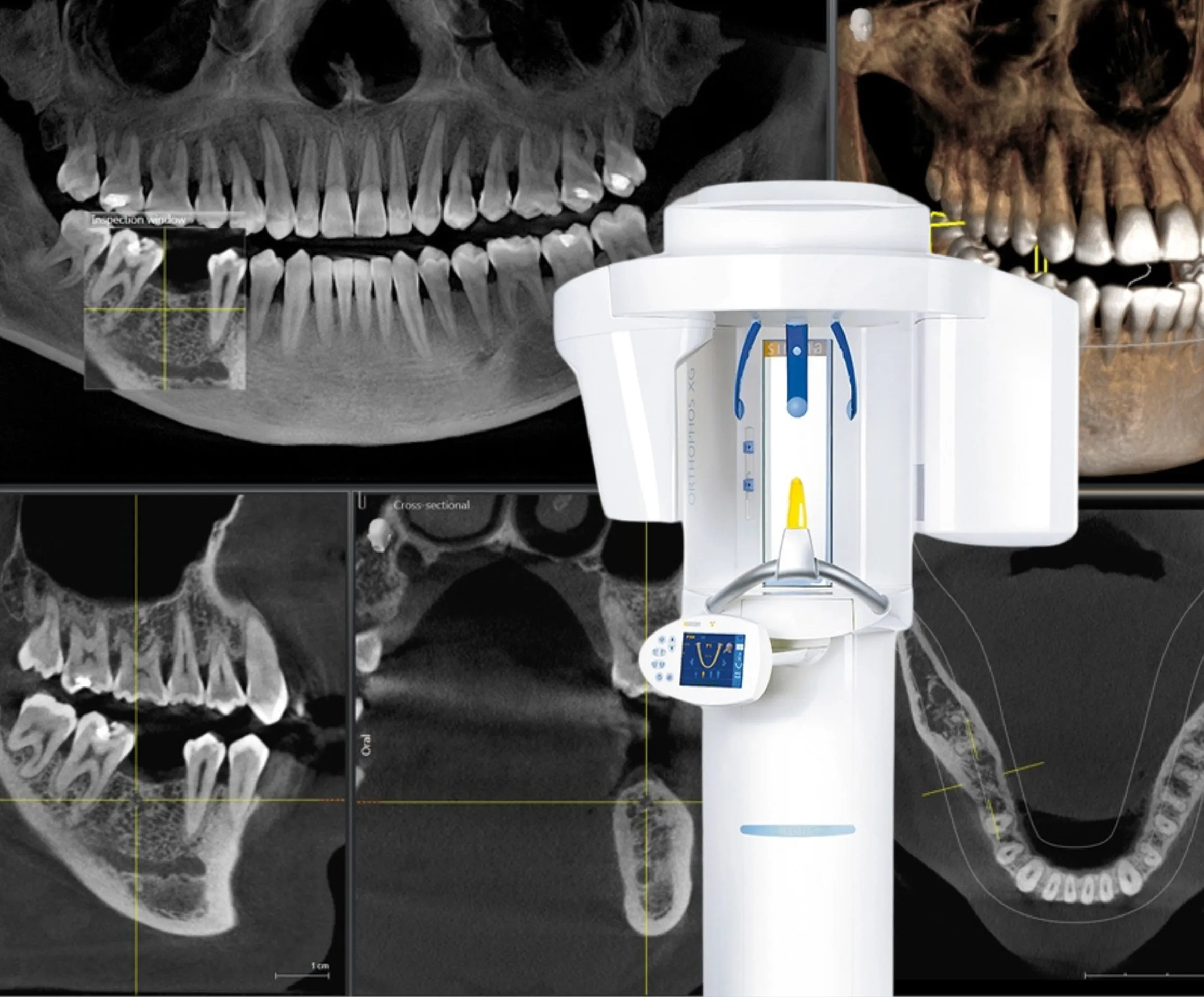Dental 3D X-ray